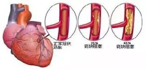 心脏突发不适深度解析，症状、原因与应对之道